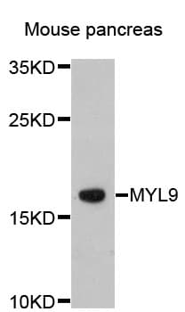 Polyclonal Rabbit anti-Human MLC2 / MYL9 Antibody (IHC, WB)
