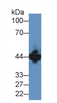 CKM / Creatine Kinase MM Antibody (aa11-367)
