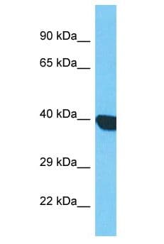 LRRC69 Antibody (aa275-324)