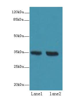 TMEM165 Antibody