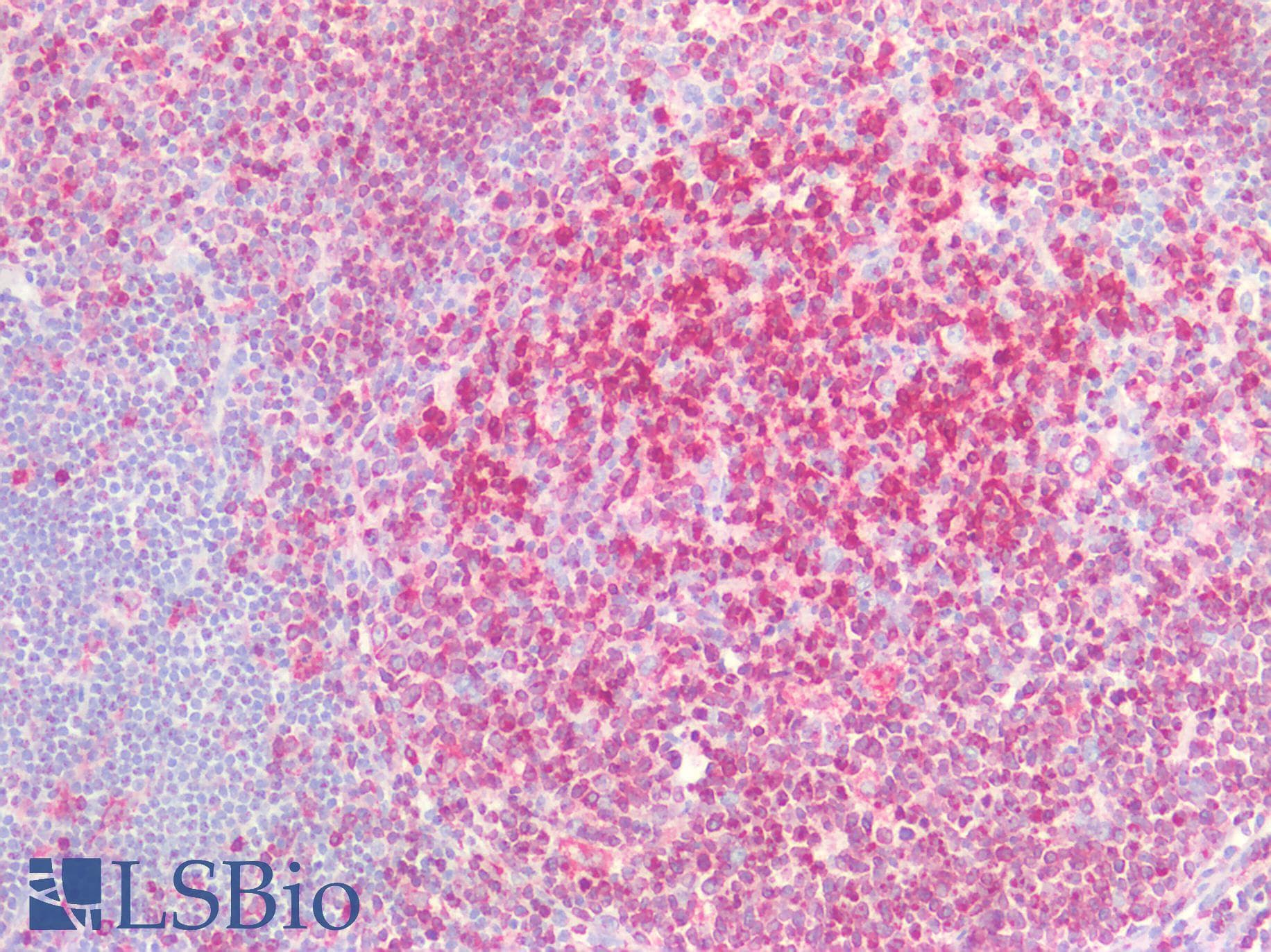 IHC-plus™ CD74 / CLIP Antibody (aa1-58)