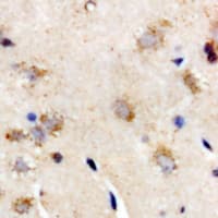 Polyclonal Rabbit anti-Human IL28B Antibody (IHC, WB)