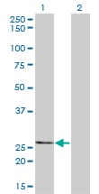 Monoclonal Mouse anti-Human THTPA Antibody (clone 3F6, WB)