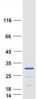 Human CCDC140 Protein (Recombinant Myc-DDK (Flag))