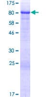 Human TSKS Protein (Recombinant GST)