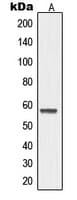 MMP19 Antibody (N-Terminus)