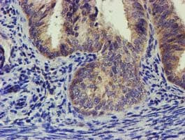 EIF4E2 / IF4e Antibody (clone OTI4E7)