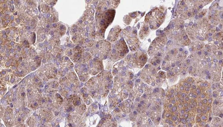 Polyclonal Rabbit anti-Human NSDHL Antibody (IHC, WB)