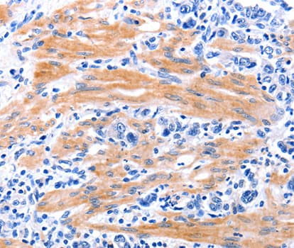 GDF9 / GDF-9 Antibody
