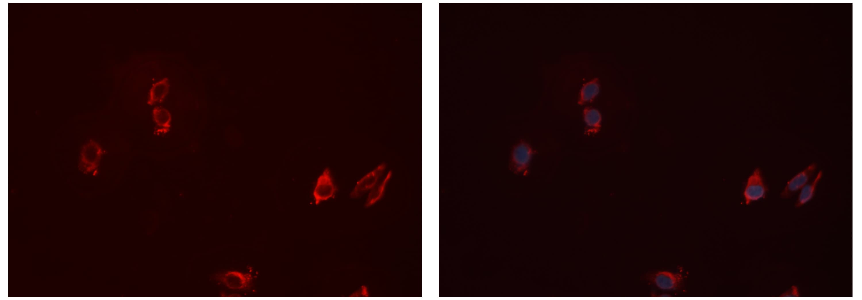 Polyclonal Rabbit anti-Human CD32A Antibody (IF, WB)