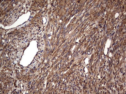 MTDH / Metadherin Antibody (aa70-582, clone OTI2F11)