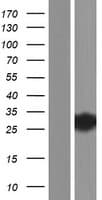 TTC9B Protein (Over-Expression Lysate Myc-DDK (Flag))