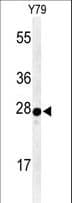AANAT Antibody (aa27-54)