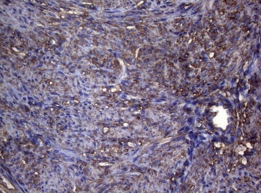 S100A9 / MRP14 Antibody (clone OTI3F8)