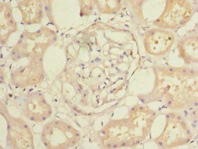 Polyclonal Rabbit anti-Human CCDC108 Antibody (Coiled-coil domain, IHC, WB)
