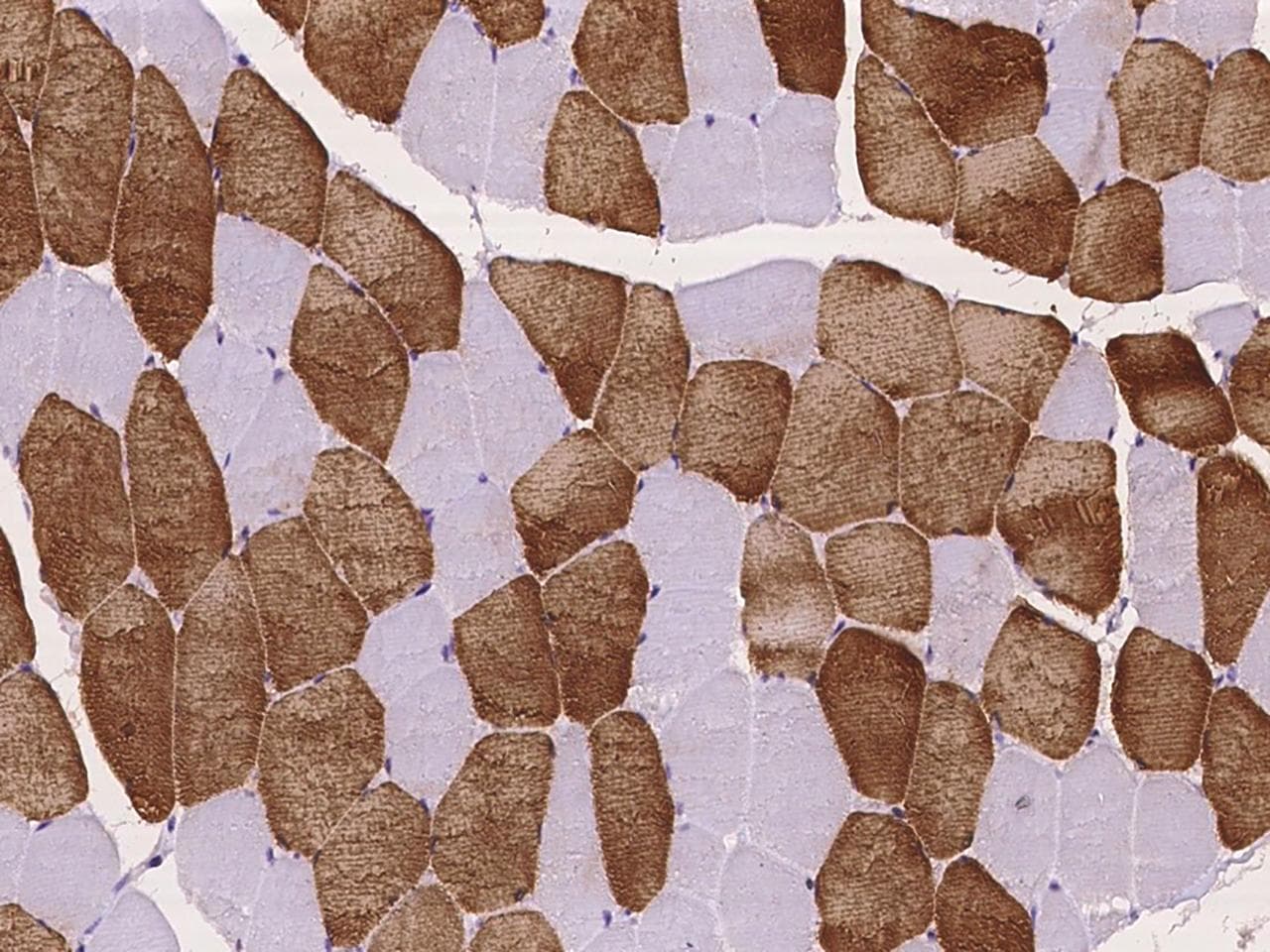 MYL3 Antibody