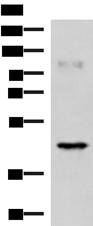 Polyclonal Rabbit anti-Human GRAB / RAB3IL1 Antibody (WB)