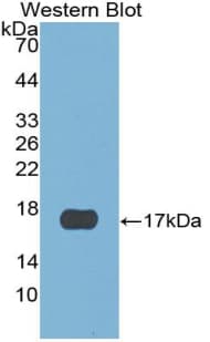 CST6 / Cystatin E/M Antibody (aa29-149)