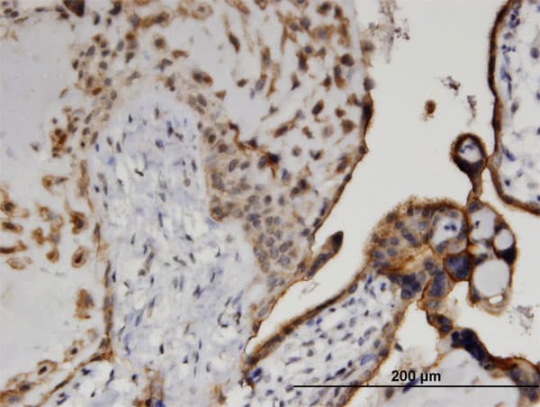 CSNK1D Antibody (clone 4H8)