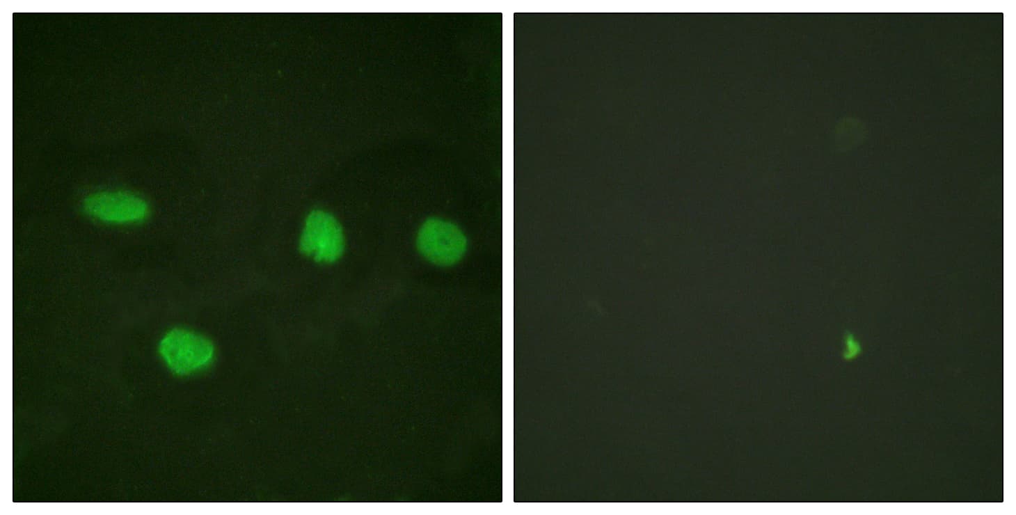 TP53BP1 / 53BP1 Antibody (aa1-50)