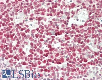 IHC-plus™ Monoclonal Mouse anti-Human IKZF1 / IKAROS Antibody (clone 1A12-F2-D8, IHC, WB)