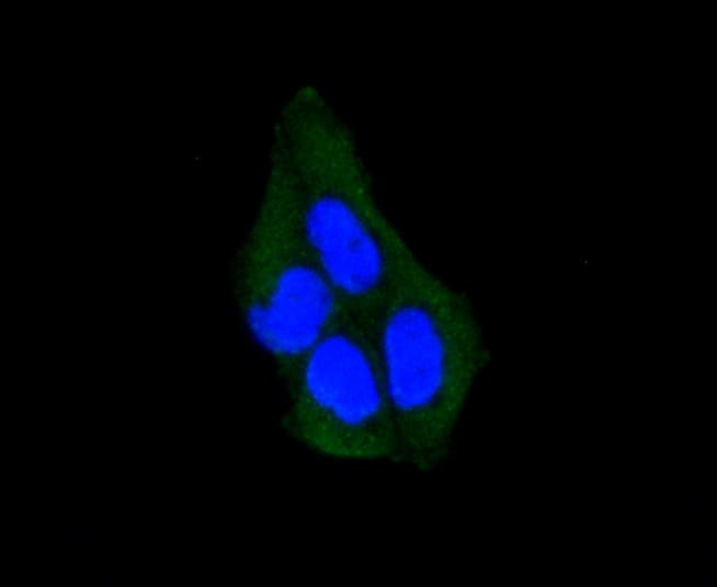 ARRB1 / Beta Arrestin 1 Antibody