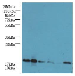 Polyclonal Rabbit anti-Human UBE2G2 Antibody (IHC, WB)