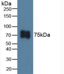 ITGB6 / Integrin Beta 6 Antibody (aa131-371, APC)