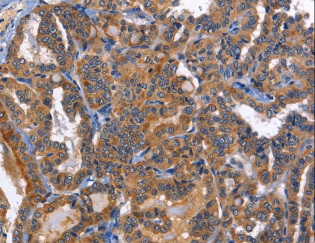 MUSK Antibody