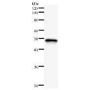 HOXB5 Antibody (clone 133C3a)