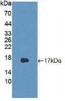 CDKN2B / p15 INK4b Antibody