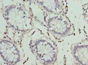 Polyclonal Rabbit anti-Human HKDC1 Antibody (IHC, WB)