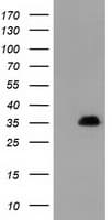 SULT1A1 / Sulfotransferase 1A1 Antibody (clone OTI1G10)