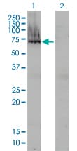 Monoclonal Mouse anti-Human Alpha-Fetoprotein Antibody (clone 1G7, IF, WB)