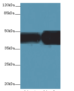 IHC-plus™ ACADL Antibody