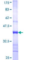 Human NBAS / NAG Protein (Recombinant GST)