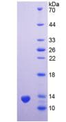 Human PSCA Protein (Recombinant His)