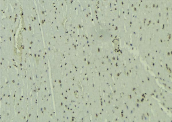 NSD3 / WHSC1L1 Antibody