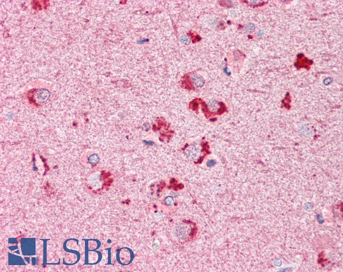 IHC-plus™ RIF1 Antibody (aa2076-2089)