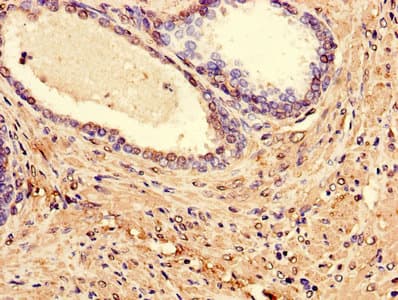 Polyclonal Rabbit anti-Human LPXN / Leupaxin Antibody
