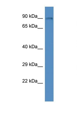 TOP1 / Topoisomerase I Antibody (aa50-99)