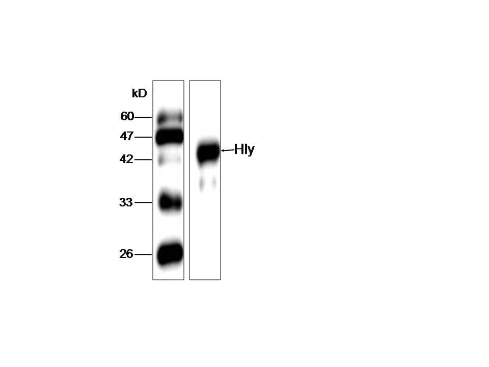 Monoclonal Mouse anti-Listeria monocytogenes Listeria monocytogenes Hly Antibody (clone BU-33, aa20-119, WB)
