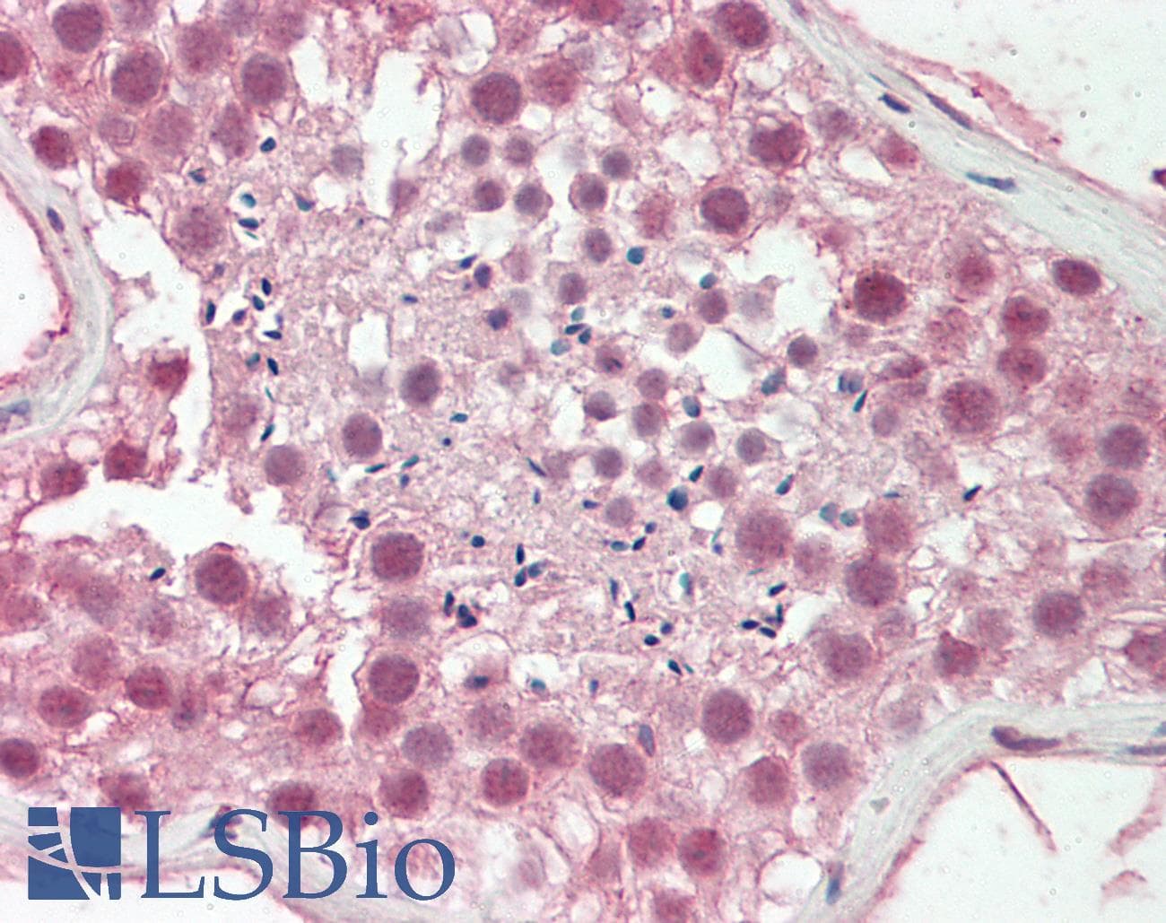 Polyclonal Rabbit anti-Human BAF60B / SMARCD2 Antibody (aa440-489, IHC, WB)