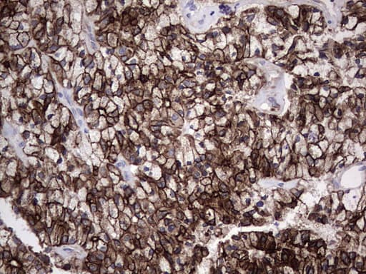 Monoclonal Rat anti-Human Acidic Cytokeratin Antibody (clone 9H3, IHC)