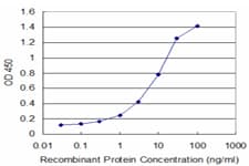 IHC-plus™ Monoclonal Mouse anti-Human XBP1 Antibody (clone 2D9, IHC, WB)