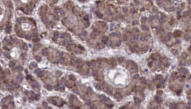 Polyclonal Rabbit anti-Human CCKBR / Cckb Antibody (IHC, IF, WB)
