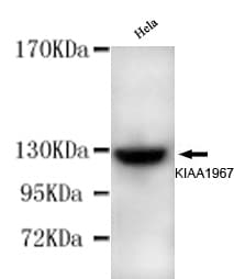 CCAR2 / KIAA1967 Antibody (N-Terminus)