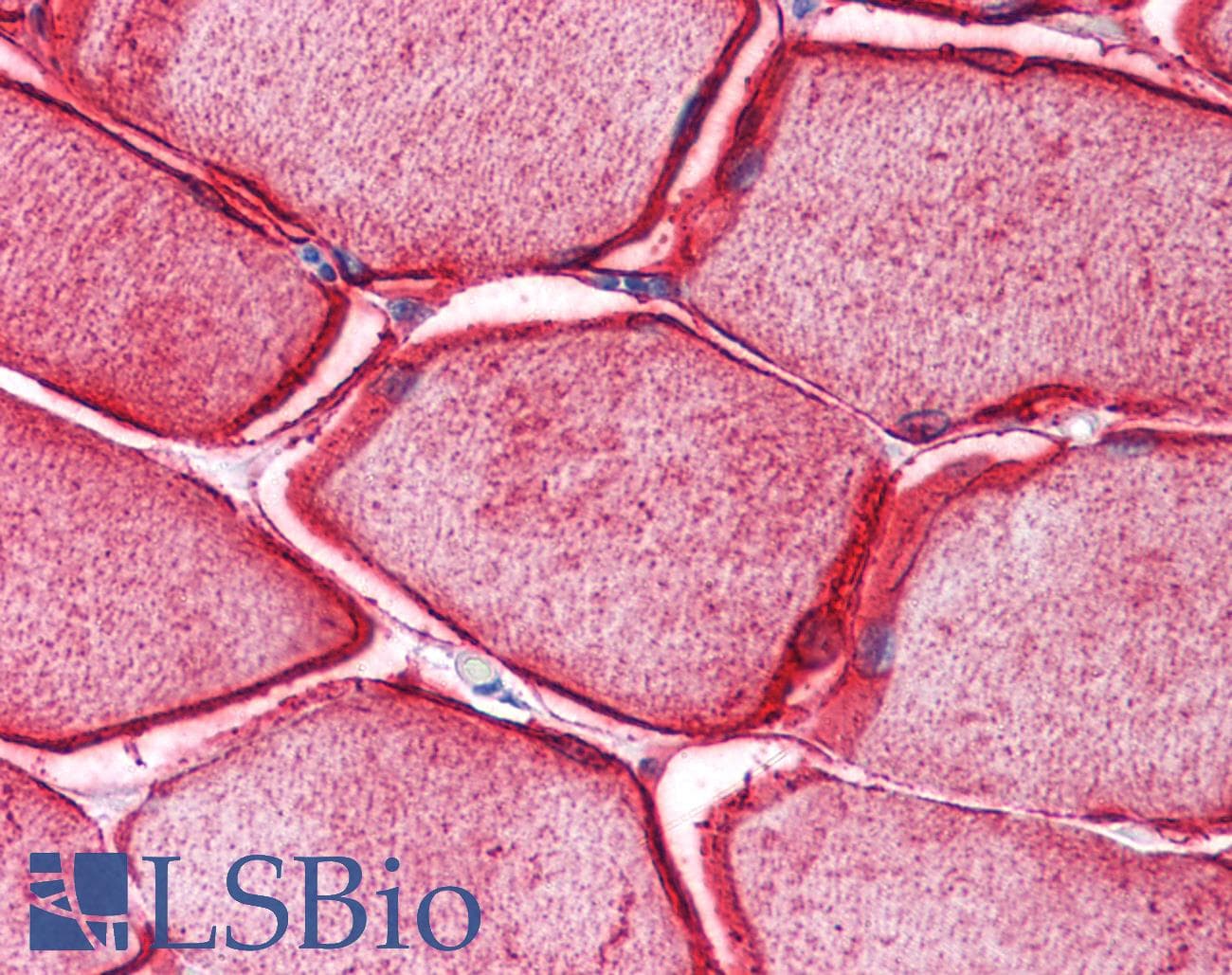 IHC-plus™ Polyclonal Rabbit anti-Human SYPL2 Antibody (IHC, IF, WB)