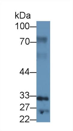 SPRY2 / Sprouty 2 Antibody (aa116-305)