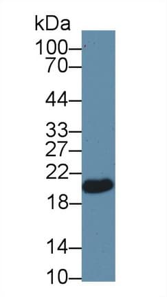 GPX4 / MCSP Antibody (aa74-197)
